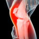 ACL TEARS: OPERATIVE AND NON-OPERATIVE TREATMENTS