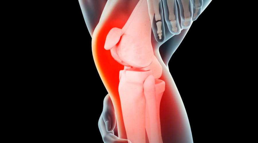 ACL TEARS: OPERATIVE AND NON-OPERATIVE TREATMENTS